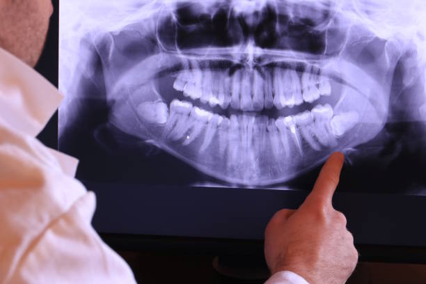 Best Emergency Denture Repair in Hammond, IN